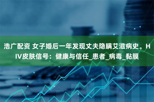 浩广配资 女子婚后一年发现丈夫隐瞒艾滋病史。HIV皮肤信号：健康与信任_患者_病毒_黏膜
